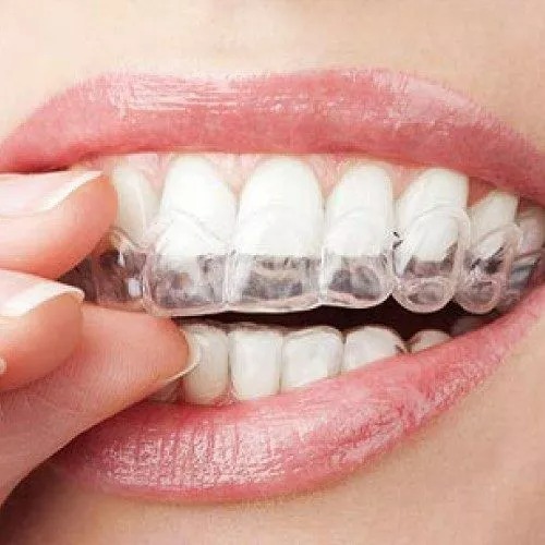 Veneers: Enhancing Your Smile With Minimal Tooth Reduction