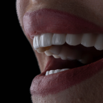 Understanding The Different Types Of Dental Fillings
